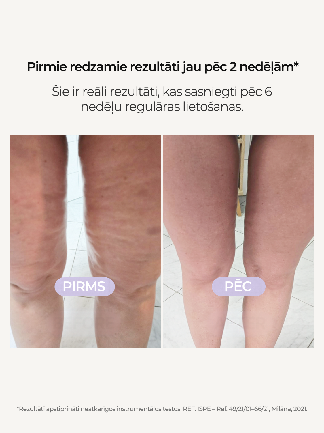 Pretcelulīta masāžas rullis