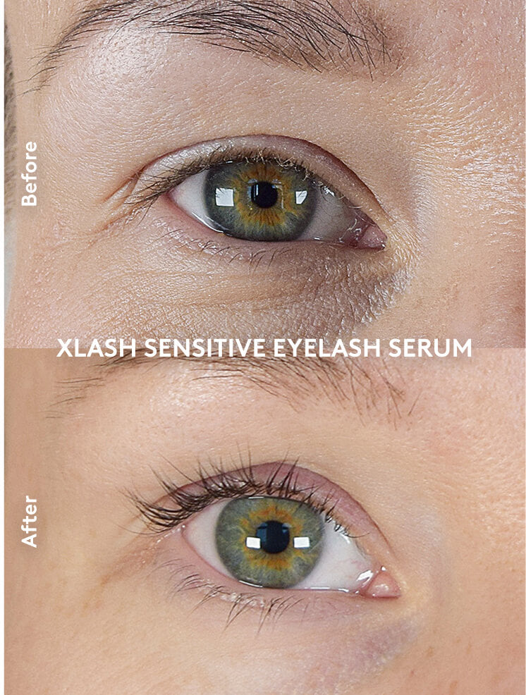 Xlash Skropstu serums jutīgām acīm 3ml