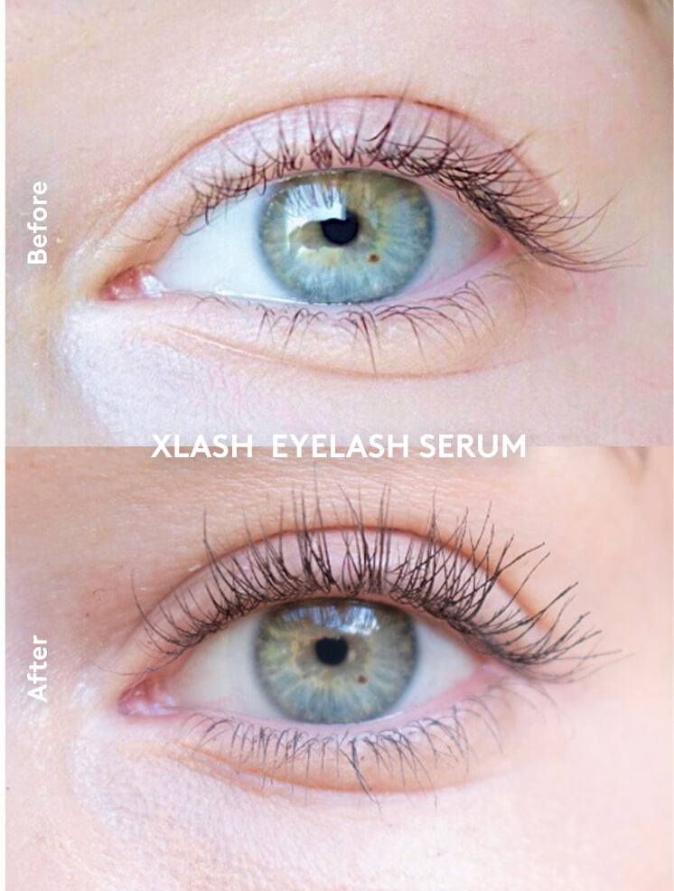 Xlash Skropstu Serums 3 ml